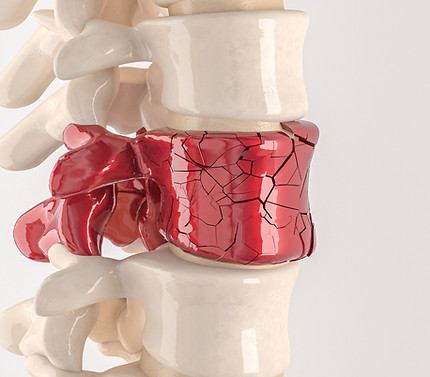 chiropractor-west-jordan