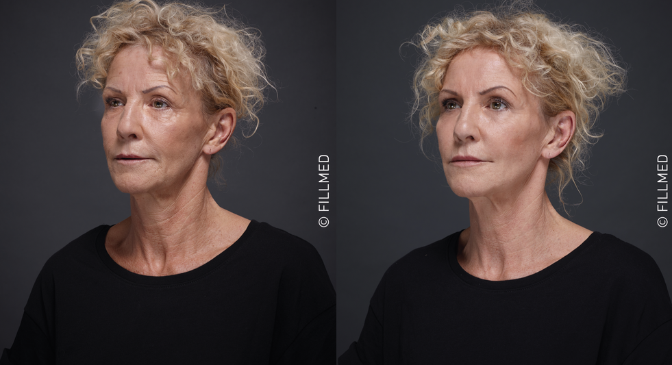 Screenshot 2021-11-13 at 01.45.42.png