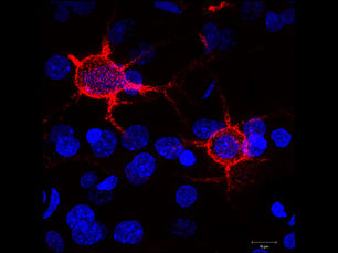 Somatosensory cortical cells in mouse brain