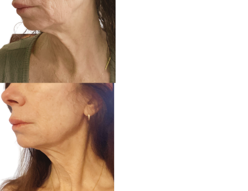 Menopausal Skincare Professional