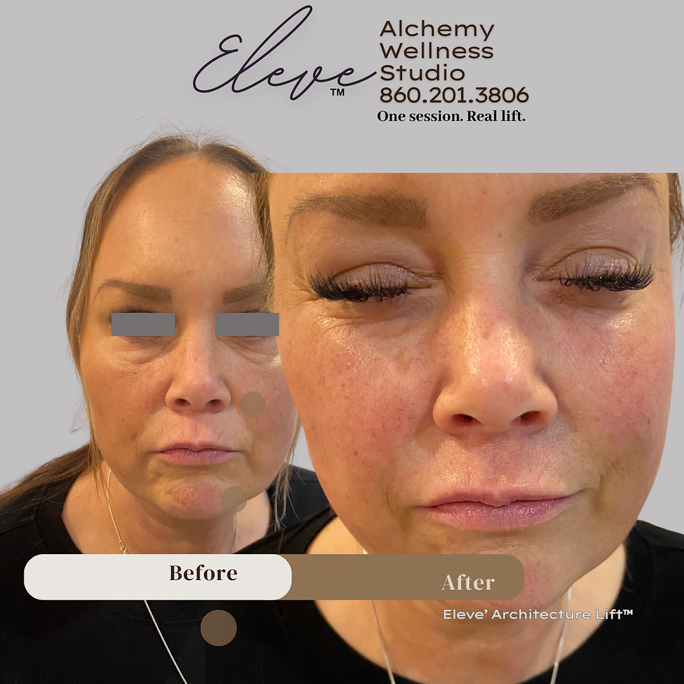 Elevé Architectural Lift™ for the Eyes