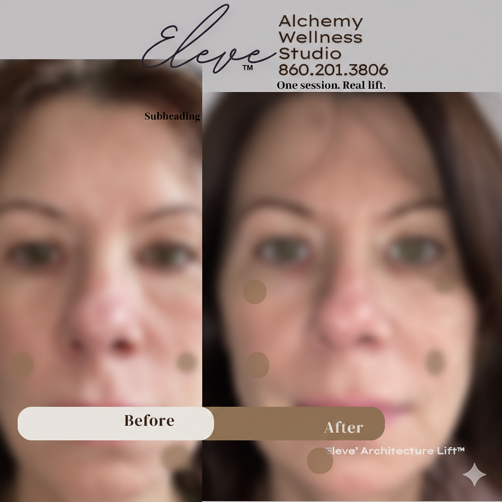 Supporting facial structure and skin vitality through a thoughtful, non-invasive approach to lift.