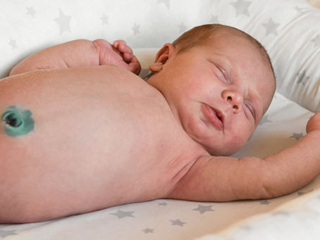 Caring for baby's umbilical cord 