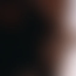 Wearable Tech in the NHS’s Next Phase of Healthcare Outcomes Acceleration | Supporting Patients with Rare and Chronic Conditions.