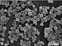 SEM of nanocarriers under development