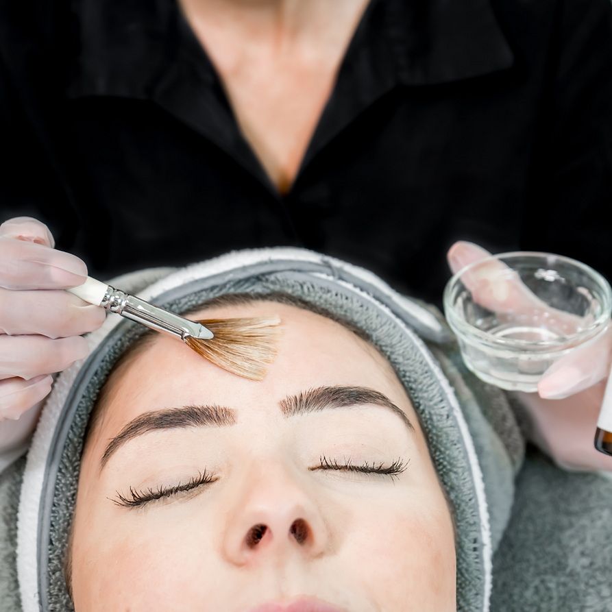 Chemical peel treatment.png