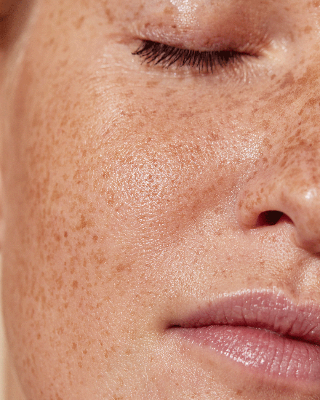 signature renew treatment