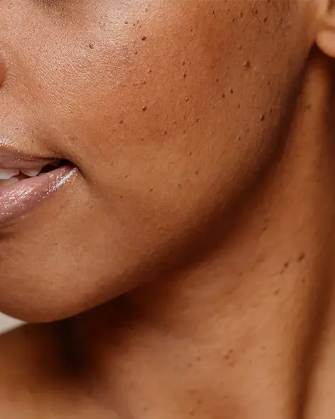 signature clear treatment