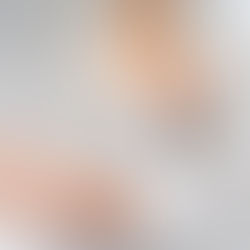 Top Choices of Tear Drop Breast Augmentation
