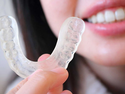 マウスピースで噛みすぎ防止