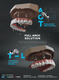 TruAbutment
