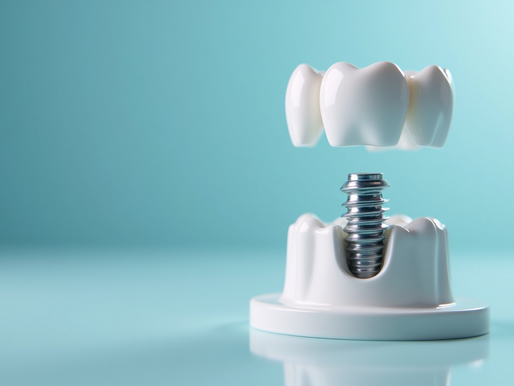 Revolutionize Your Smile with Dental Implants