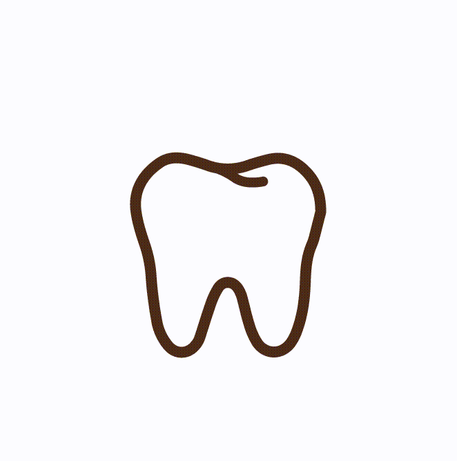 Dental-Fillings-1-1.gif