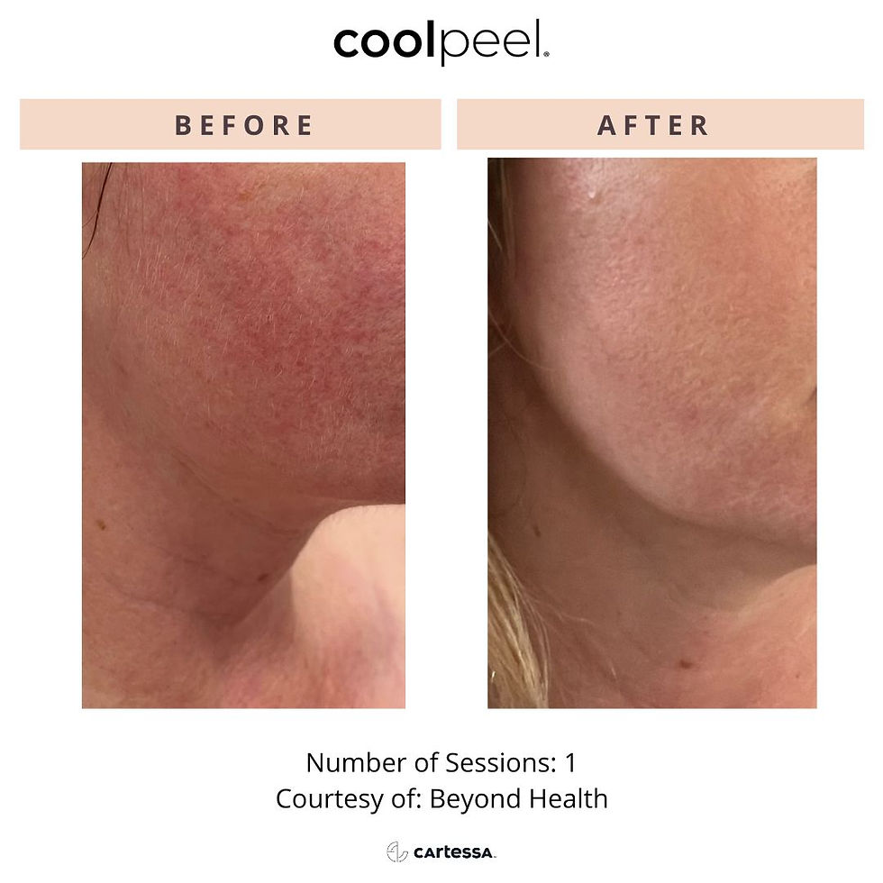 CoolPeel173444683519