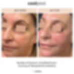 CoolPeelFusionBeautyBomb173437797048