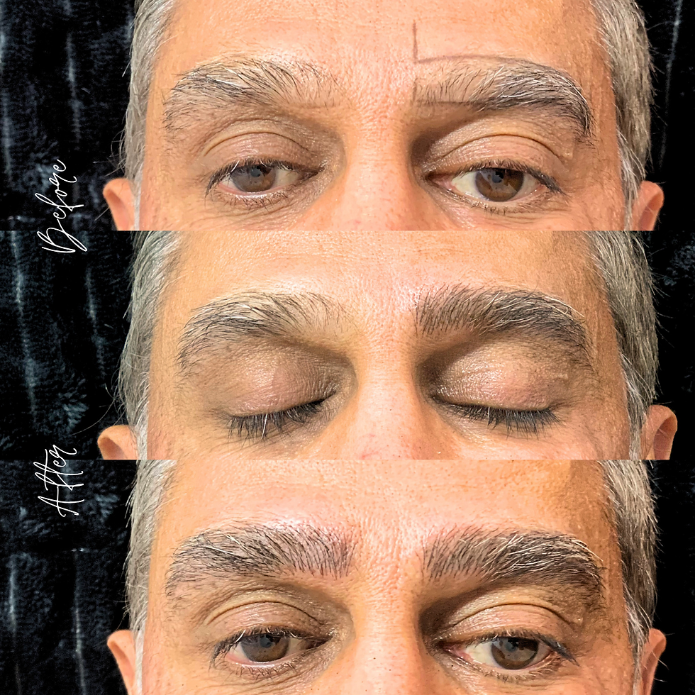 Before, During & After