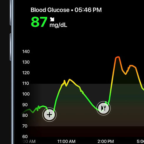 real-time-glucose-tracking-grey-bg.jpeg