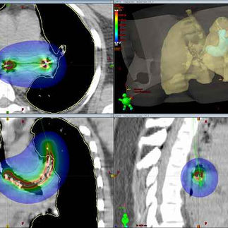 Varian oncologie