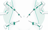 Bras robotisés effectuant une chirurgie digestive abdominale.