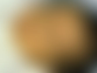 newborn jaundice