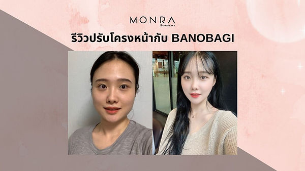 รีวิวปรับโครงหน้ากับ BANOBAGI (ตอนที่ 1)