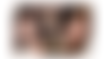 แชร์ประสบการณ์ – ผ่าตัดโครงหน้า แก้ตา แก้จมูก