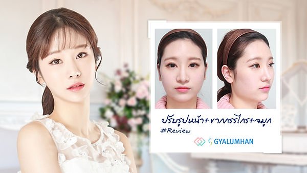 รีวิว ปรับรูปหน้า+ขากกรรไกร+จมูก ที่ Gyalumhan Plastic Surgery (กะรึมฮัน) (ตอนที่ 1)