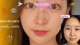 จุดเริ่มต้นเล็กน้อย☙☙☙☙แต่เป็นจุดเปลี่ยนที่ประทับใจ♡