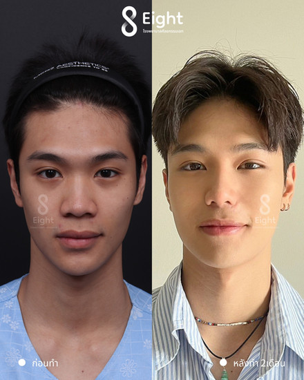 Eight Plastic Surgery หรือ โรงพยาบาลศัลยกรรมเอท