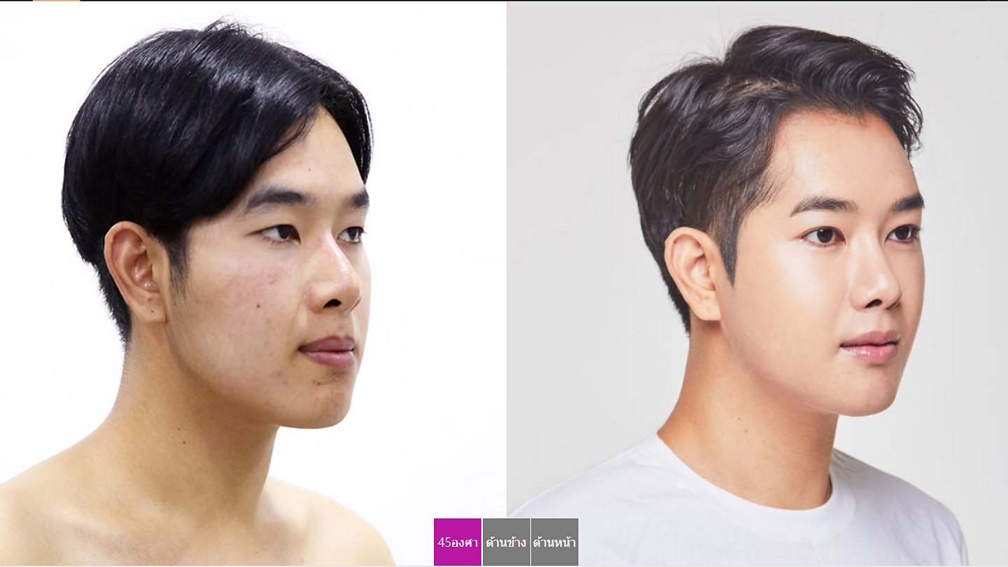 จมูกเบี้ยวแก้ได้ ทั้งสวยงามและแก้ปัญหาไปพร้อมกันในครั้งเดียว