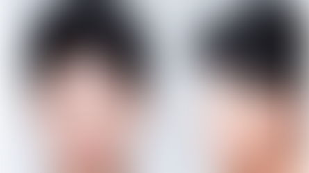 ศัลยกรรมลดขนาดจมูก ทำให้หน้ามีมิติ