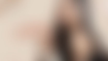 ยกกระชับ เอนโดไทน์หน้าผาก