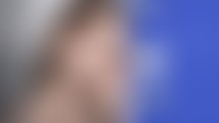 การศัลยกรรมขากรรไกรของแต่ละบุคคล