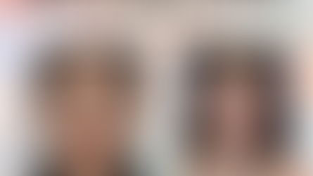 รีวิวศัลยกรรม โครงหน้า3จุด+ ตาสองชั้น มัดกล้ามเนื้อตา + ฉีดไขมันเปลือกตา