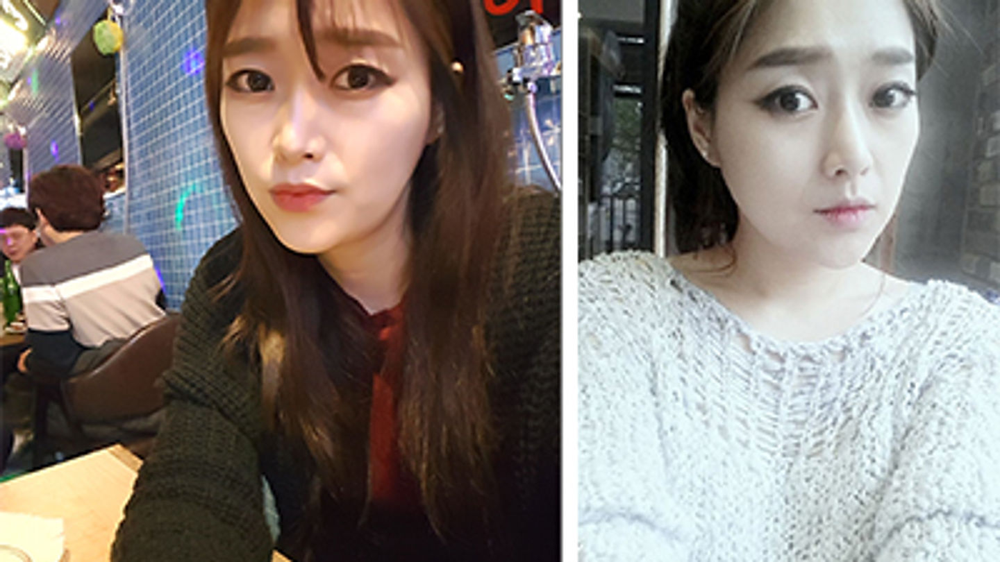 ศัลยกรรมตา จมูก พร้อมปรับโครงหน้าให้ละมุน (ตอนที่ 1)