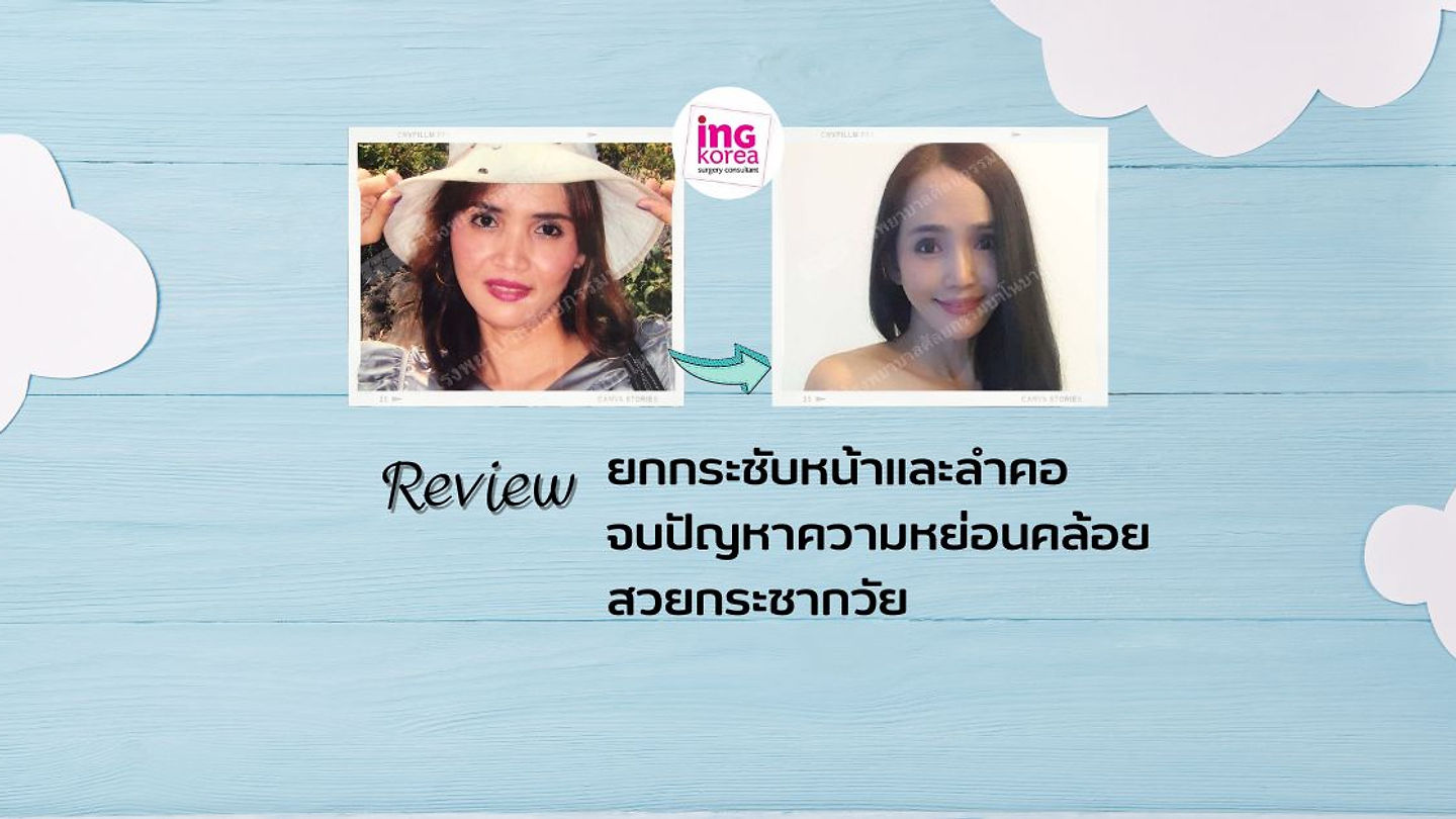 รีวิว ยกกระชับหน้าและลำคอ จบปัญหาความหย่อนคล้อย สวยกระชากวัย (ตอนที่ 2)