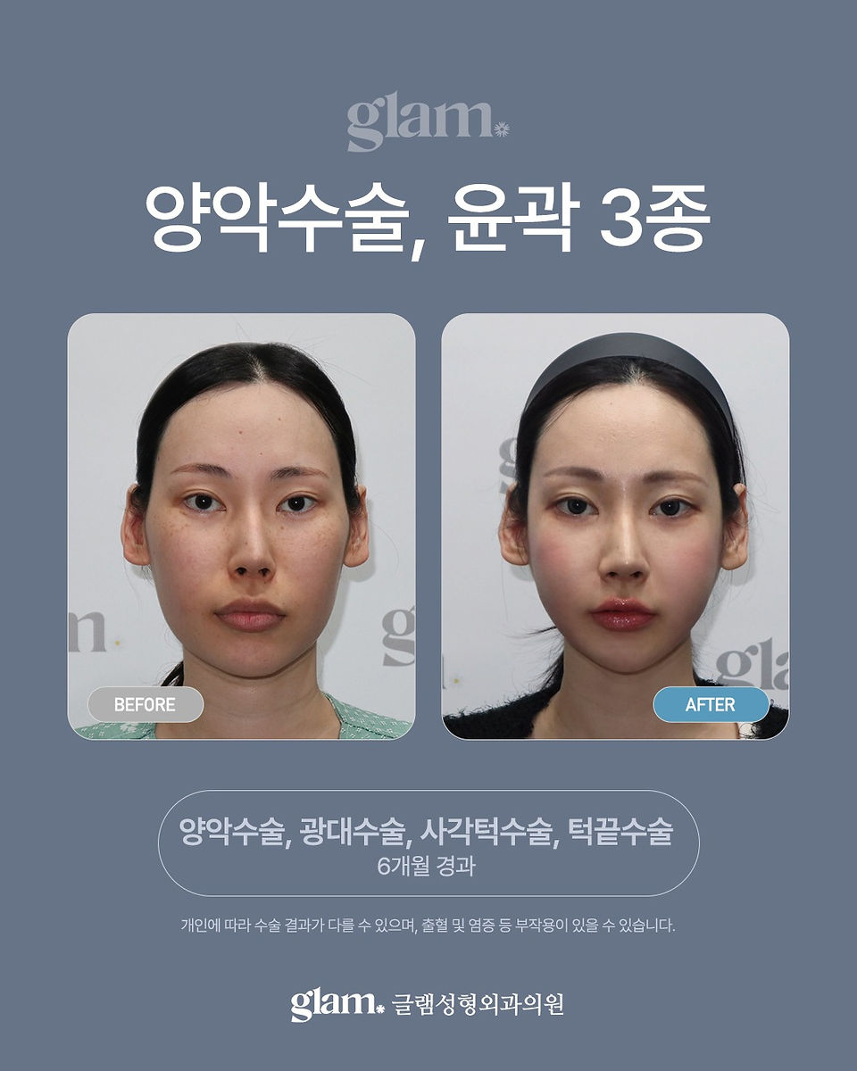 รีวิว Glam Plastic Surgery โรงพยาบาลผ่าตัดขากรรไกรและโครงหน้าเฉพาะทาง