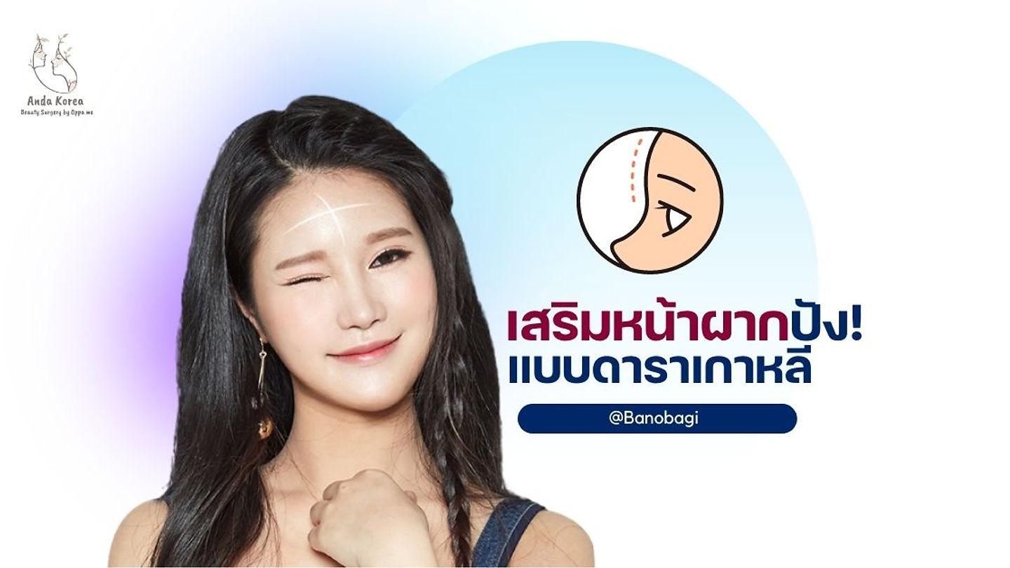 เสริมหน้าผากปัง! แบบดาราเกาหลี @Banobagi