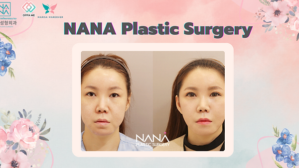รีวิวศัลยกรรมยกกระชับ (ตอนที่ 1)