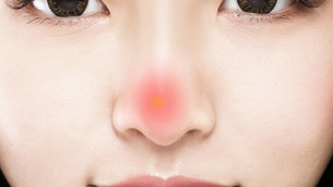 แก้จมูกเนื่องจากมีอาการอักเสบ