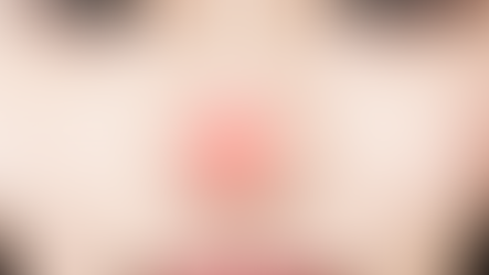 แก้จมูกเนื่องจากมีอาการอักเสบ