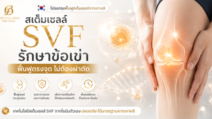 สเต็มเซลล์ SVF รักษาข้อเข่า ฟื้นฟูตรงจุด ไม่ต้องผ่าตัด