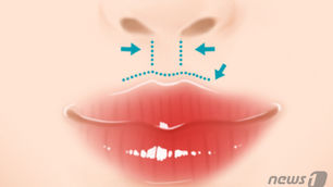 ร่องเหนือริมฝีปาก เกี่ยวข้องกับศาสตร์ความงามอย่างไร?