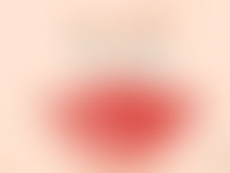 ร่องเหนือริมฝีปาก เกี่ยวข้องกับศาสตร์ความงามอย่างไร?