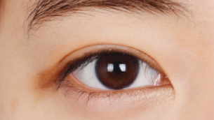 ลักษณะของตาสองชั้น