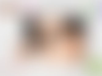 ศัลยกรรมตาผู้ชาย @Atop Plastic Surgery