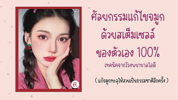การแก้ไขจมูกทะลุ ด้วยสเต็มเซลล์ตัวเอง จากโรงพยาบาลไอดี