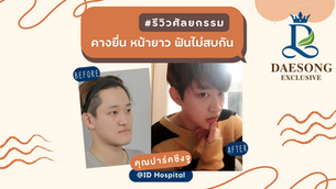 รีวิวศัลยกรรมลดคางยื่น หน้ายาว ฟันไม่สบกัน คุณปาร์คซึงจู @ID Hospital