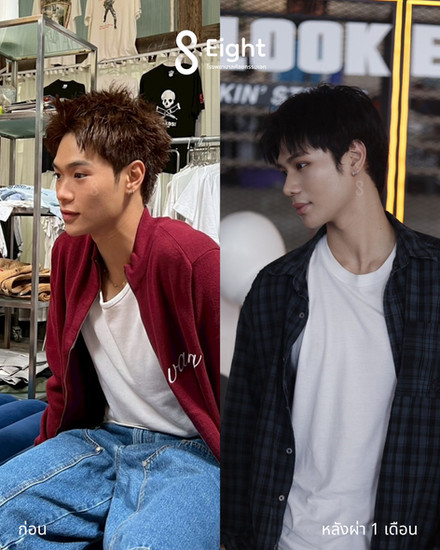 Eight Plastic Surgery หรือ โรงพยาบาลศัลยกรรมเอท
