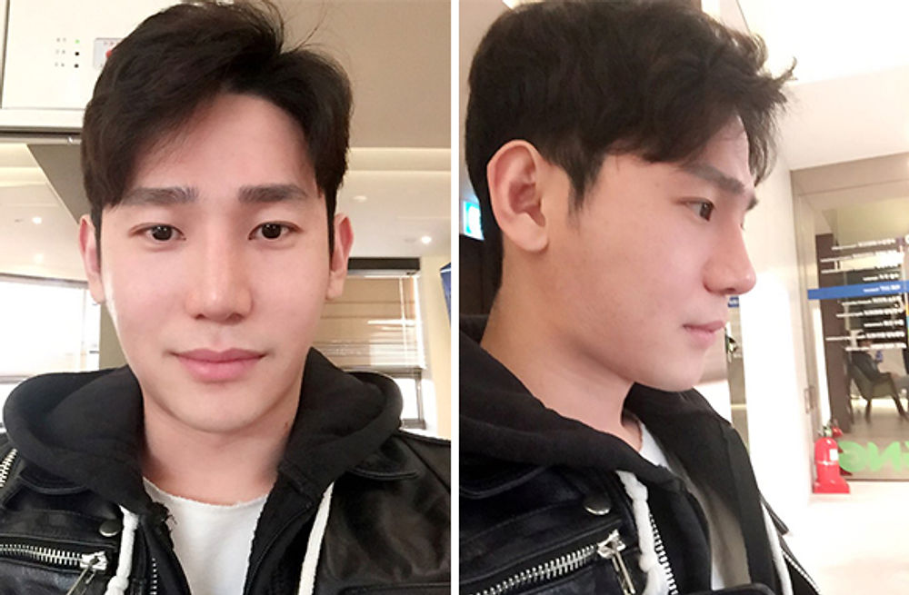 리얼스토리 사진, 지앤지병원 후기 - 지앤지병원